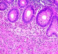 Eosin Stain